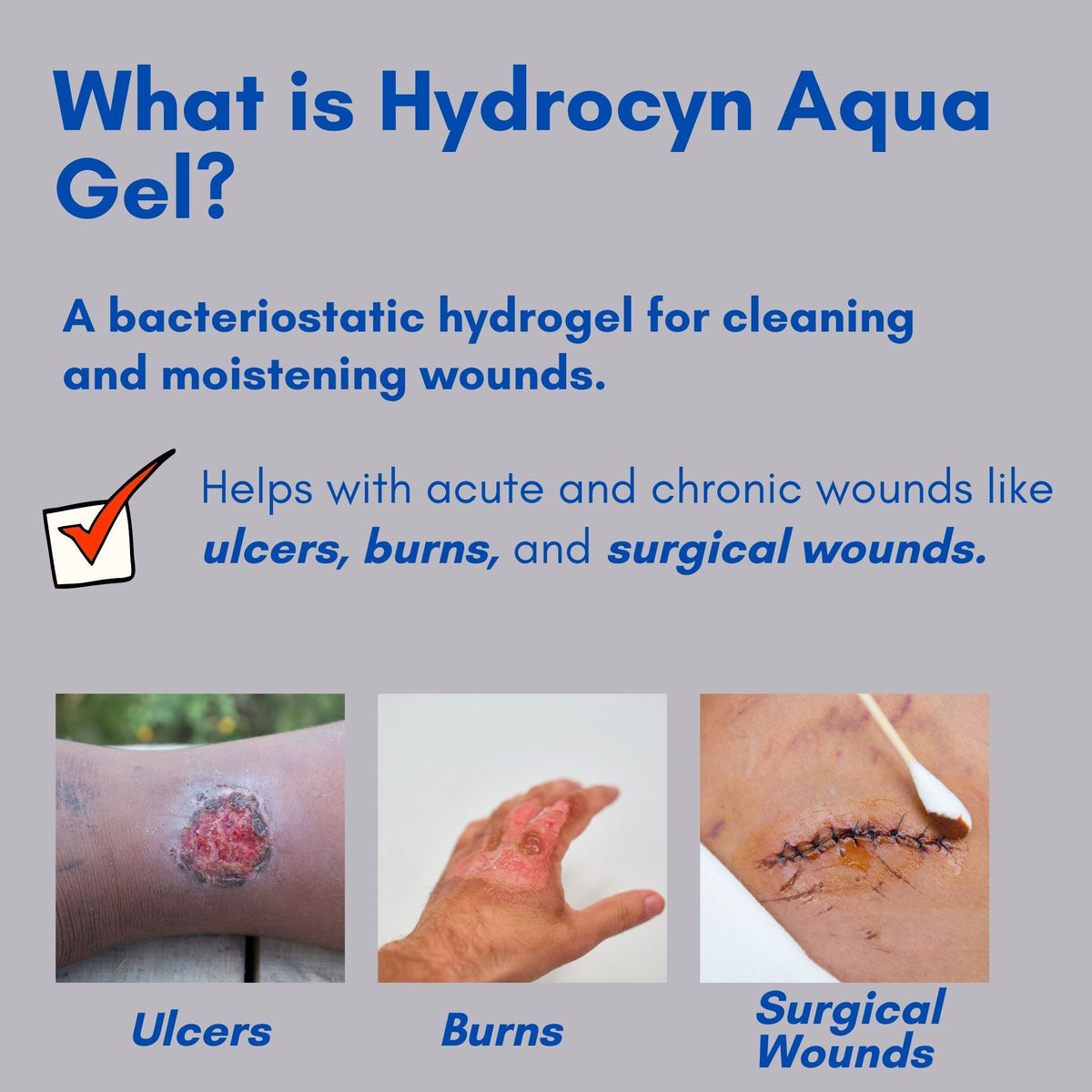Epycin Hydrocyn Aqua Wound Gel 15g Clean, Protect & Heal Wounds Fast Exp:31/0 ...