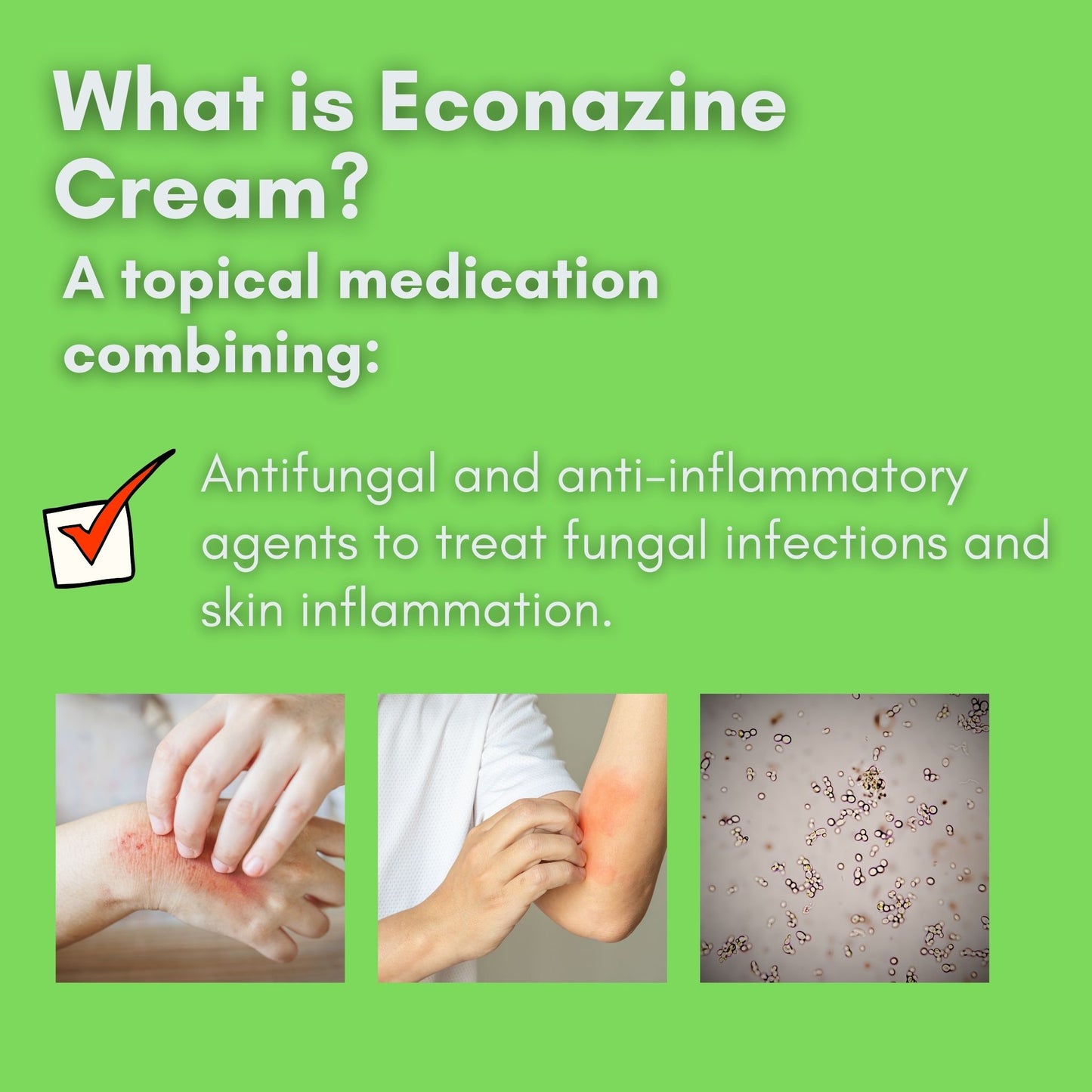 [READY STOCK] Econazine Cream 10g (Antifungal & Anti-Inflammaory/Ubat anti gatal)